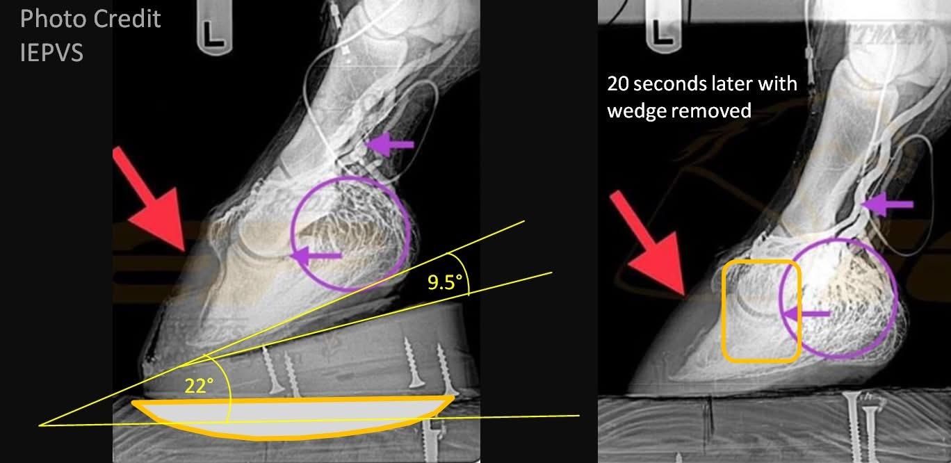 The mechanical problem in laminitis. Why would you elevate the heels?